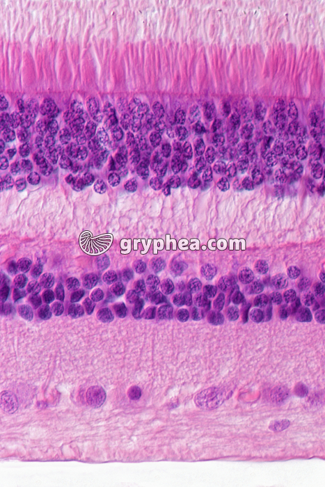 Rétine CT x200 - gryphea.org